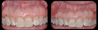 case-6