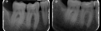 Case 5