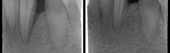 Case 1