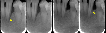 Case 2