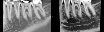 Case 6